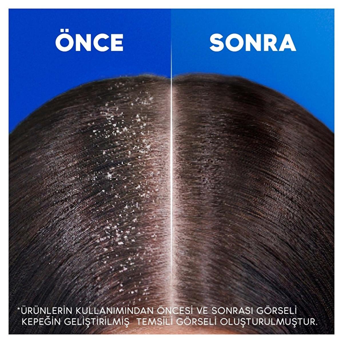 Head &amp; Shoulders Anti-Dandruff Shampoo - Dermatologically Tested, 11.16 fl oz - Anti-Dandruff Relief &amp; Eco-Friendly Packaging Head &amp; Shoulders Anti-Dandruff Shampoo - 11.16 fl oz anti-dandruff shampoo, dermatologically tested shampoo, sensitive scalp care, dandruff relief, eco-friendly packaging shampoo, hair care, scalp care, gentle shampoo, environmentally friendly, cleaner products, recycled plastic packaging, dandruff treatment, scalp health, hair health