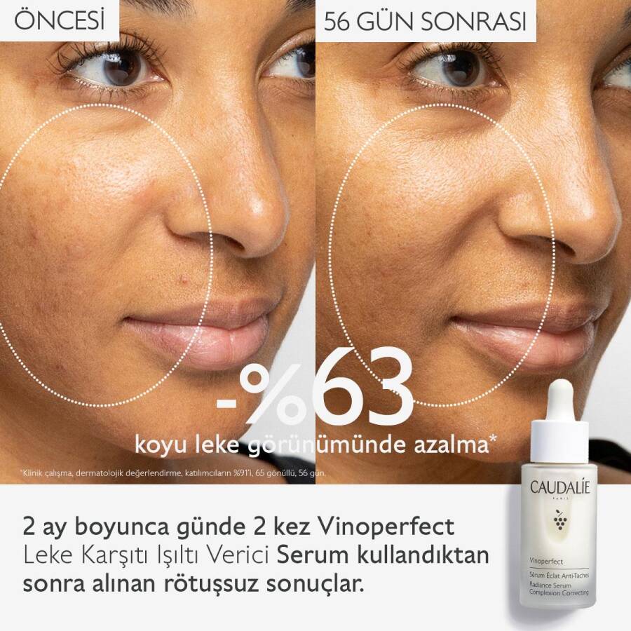 Caudalie Vinoperfect Radiance Dark Spot Serum 50 ml