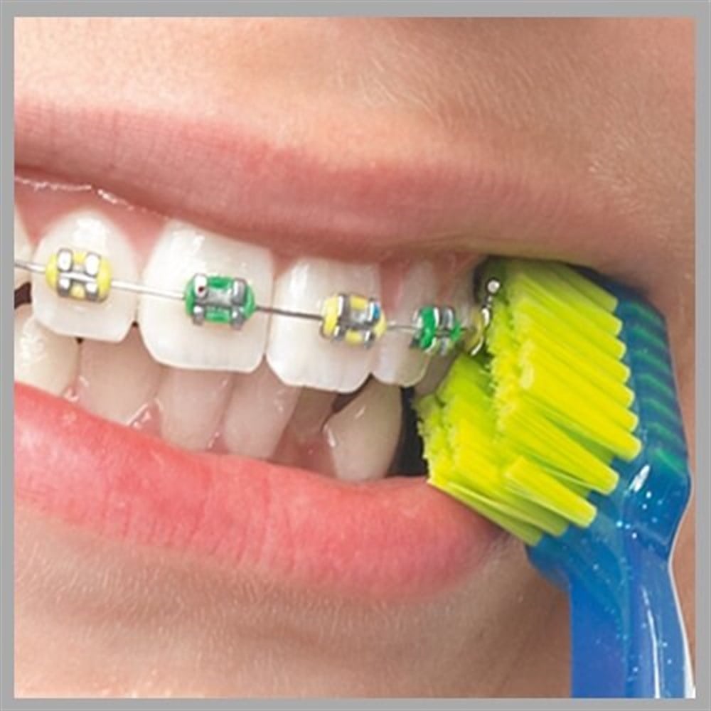 Curaprox CS 5460 Ortho Toothbrush - Ideal for Braces | Swiss Quality