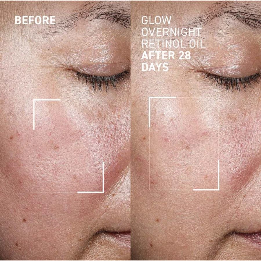 Dr. Brandt Bright This Way Glow Overnight Retinol Oil, 30ml