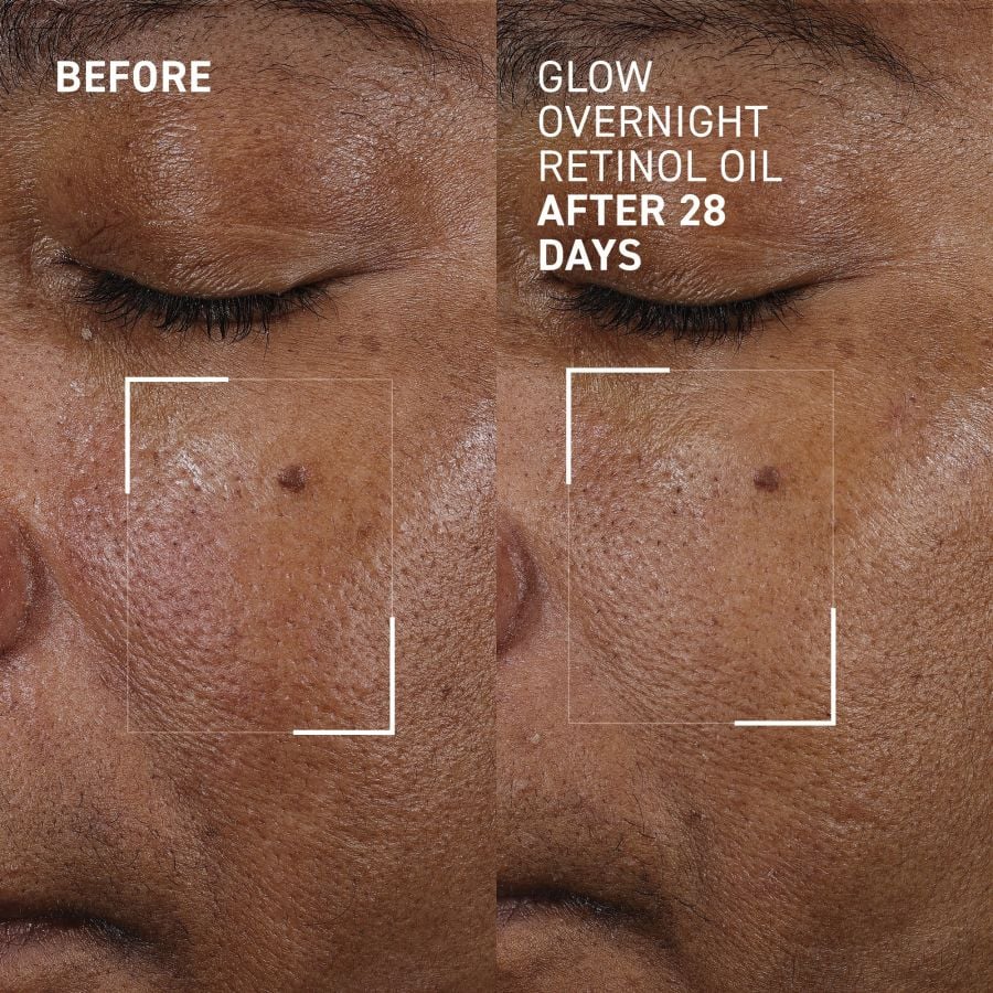 Dr. Brandt Bright This Way Glow Overnight Retinol Oil, 30ml