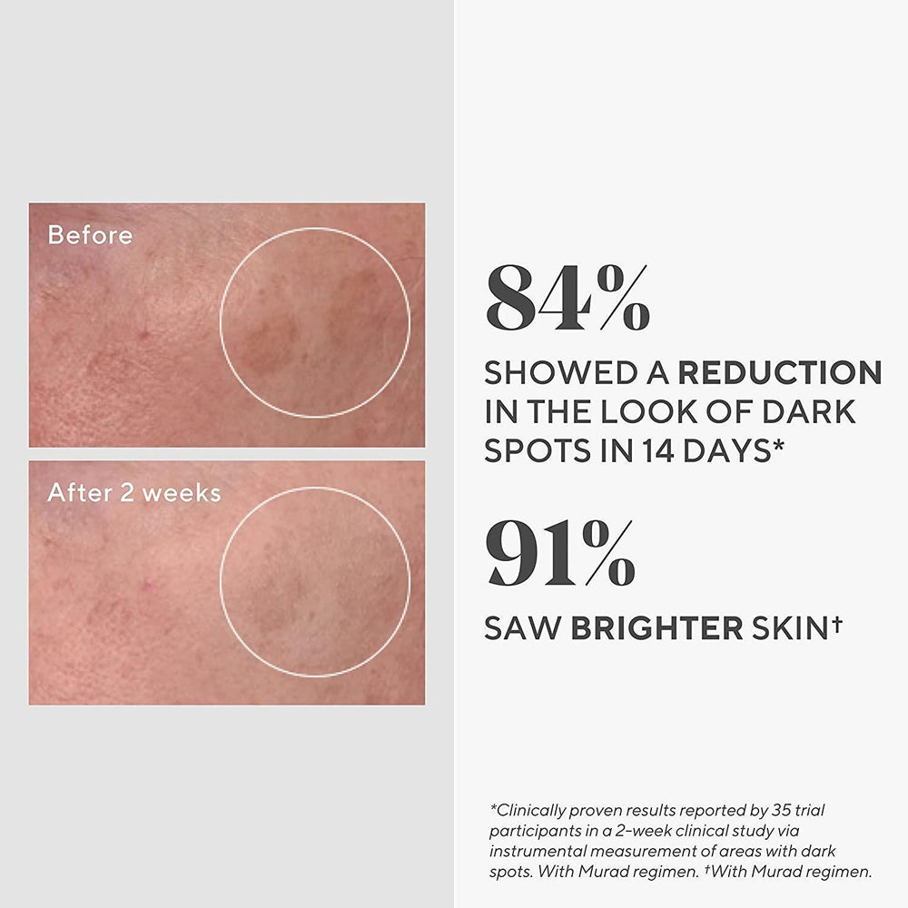 DR.Murad Dark Spot Correcting Serum - Rapidly Reduces Hyperpigmentation, Evens Skin Tone, 30ml - view 4