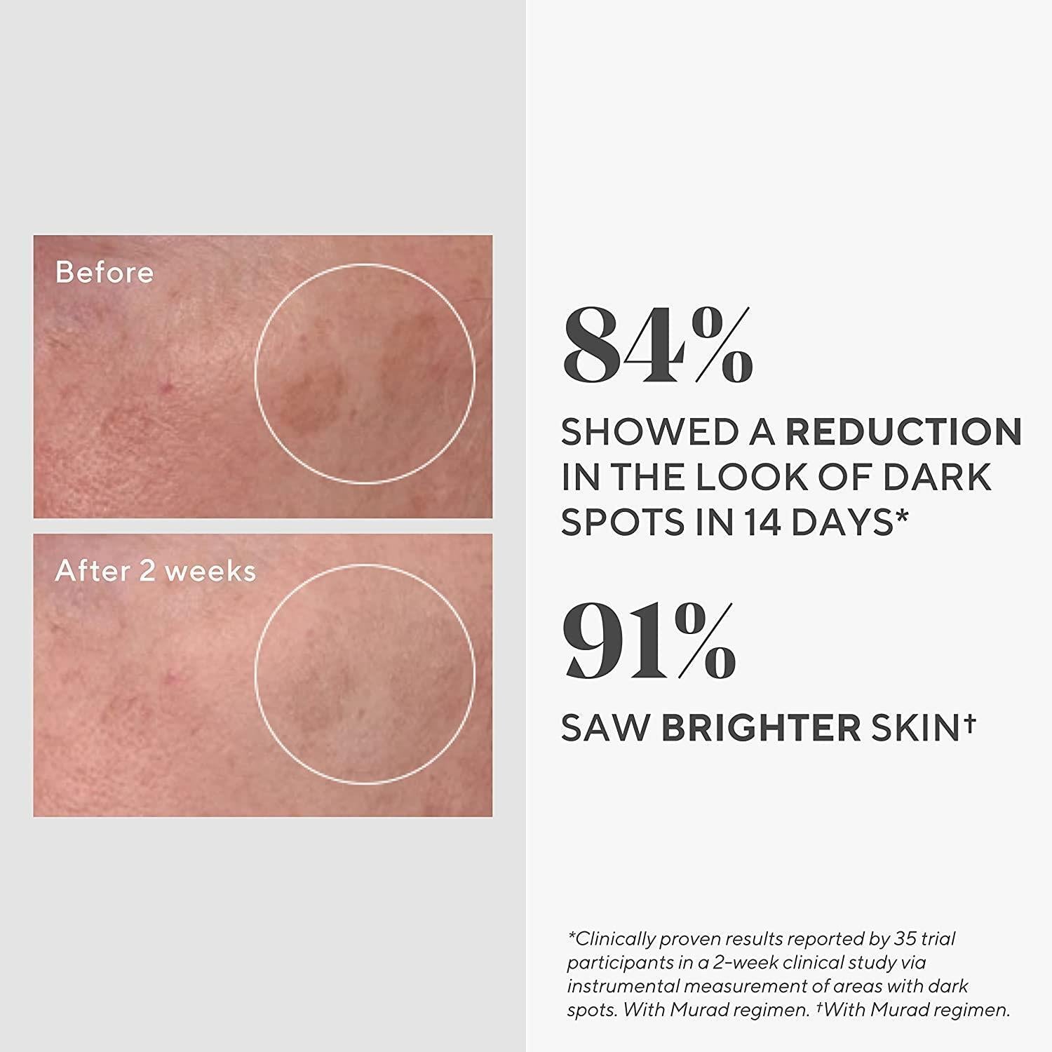 DR.Murad Dark Spot Correcting Serum - Rapidly Reduces Hyperpigmentation, Evens Skin Tone, 30ml DR.Murad Dark Spot Serum - Reduce Hyperpigmentation Dark Spot Correcting Serum, Murad Skincare, Hyperpigmentation Treatment, Even Skin Tone, Dermatologically Tested Serum, Skincare, Anti-Aging, Dark Spot Removal, Hyperpigmentation Solution, Skincare for Women, Skincare for Men, Dermatologist Recommended, Original Product, Authentic Skincare, Skincare Routine, Glow Up, Confidence Boost, Beauty Essentials