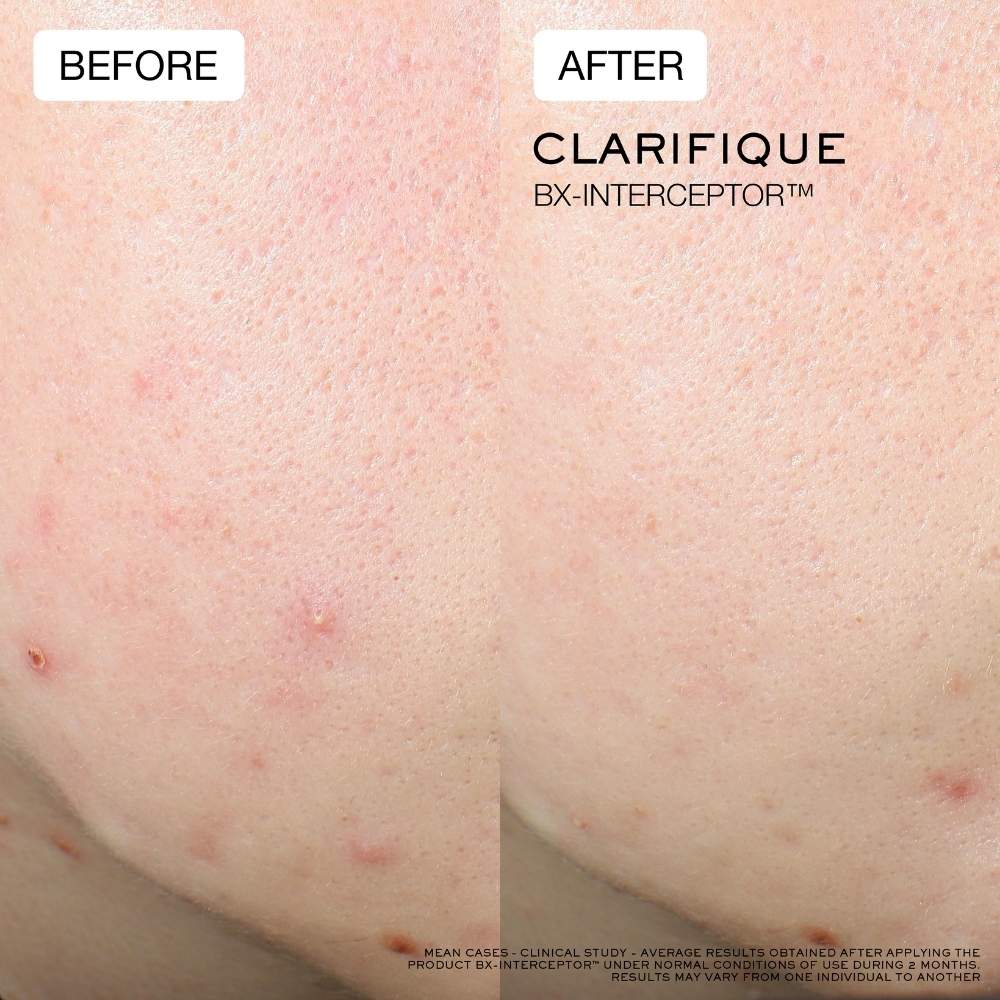 Lancome Clarifique BX-Interceptor Serum Brightening Care 30ml