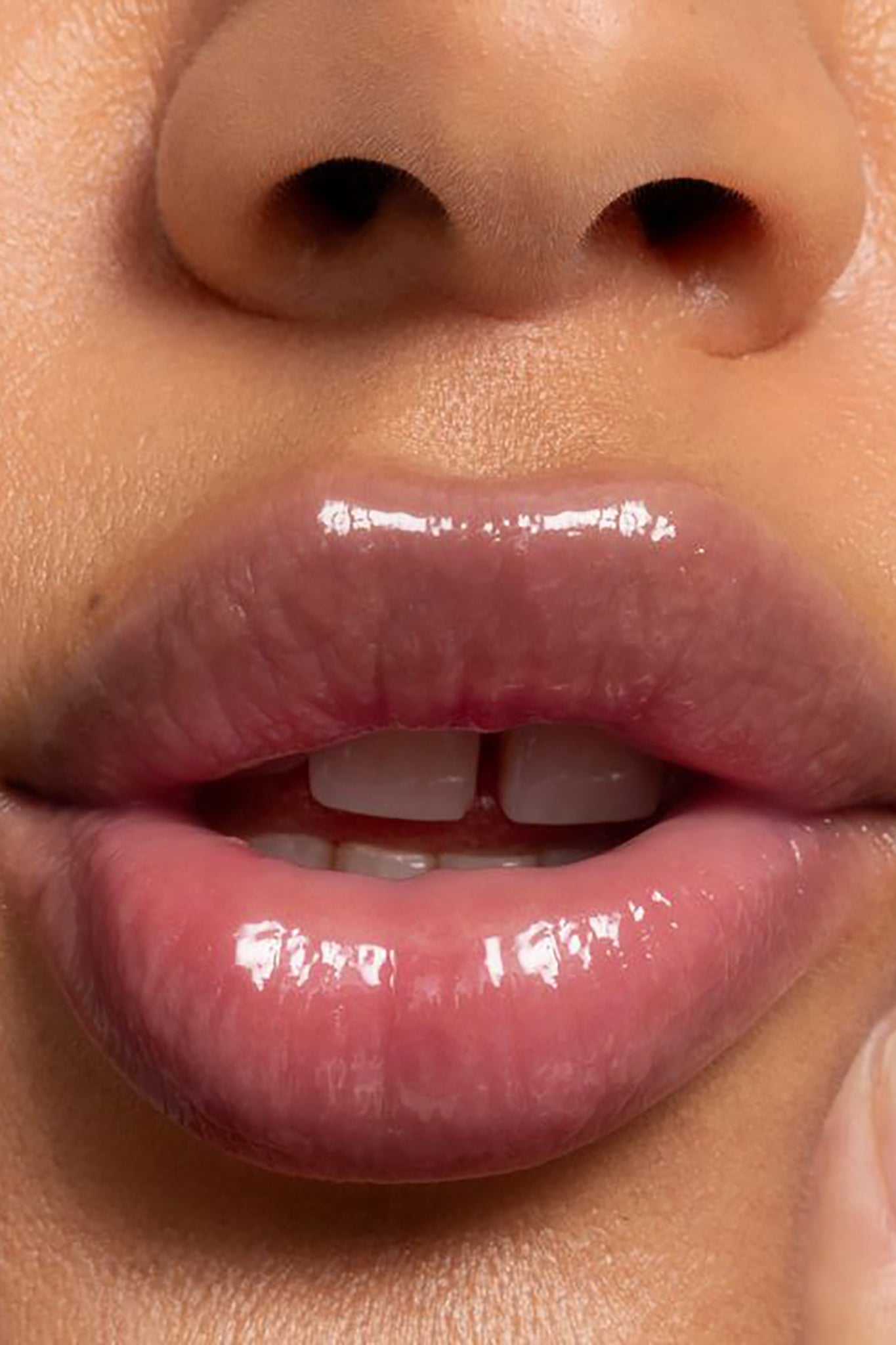 LIPID