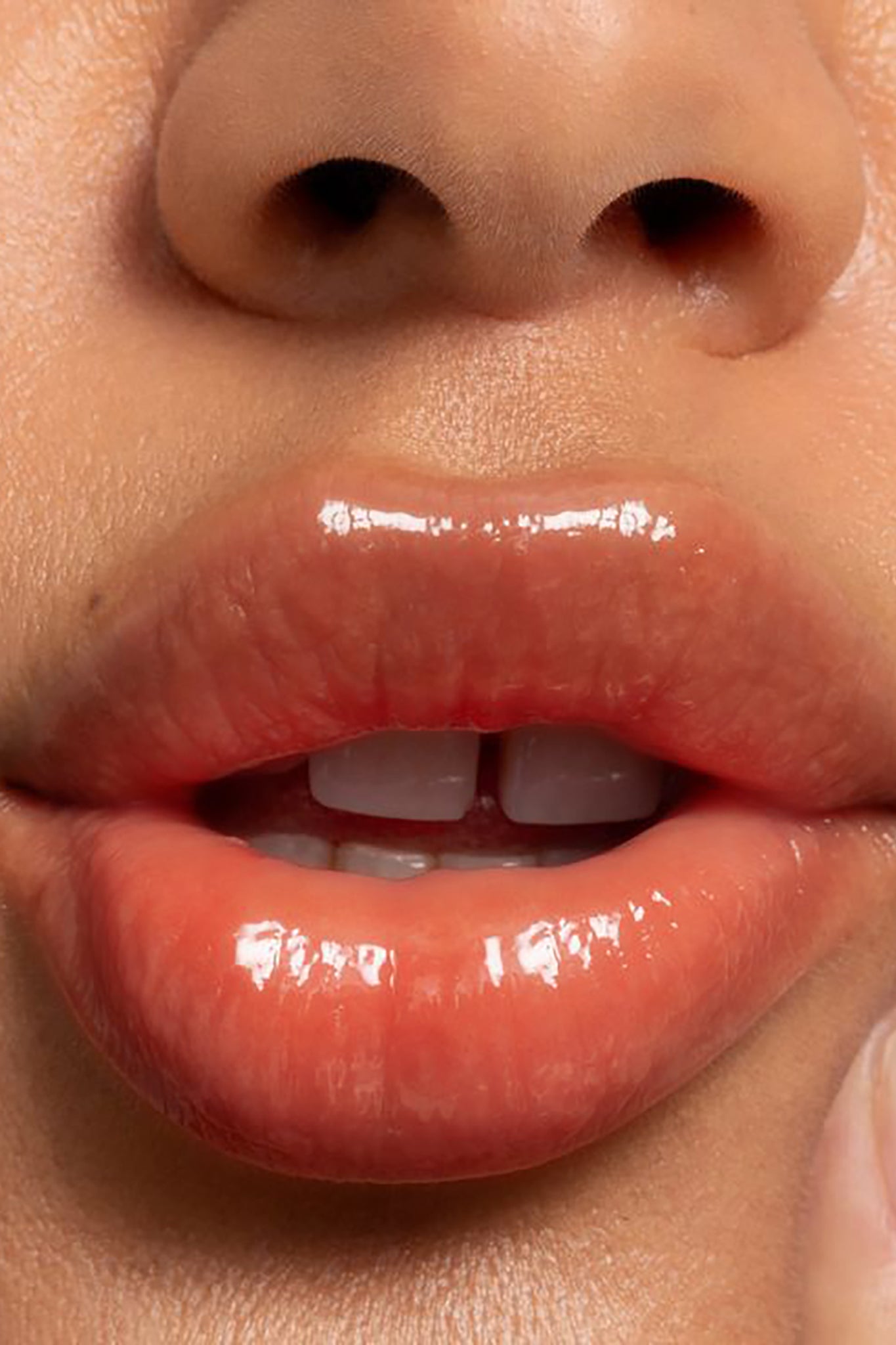 LIPID