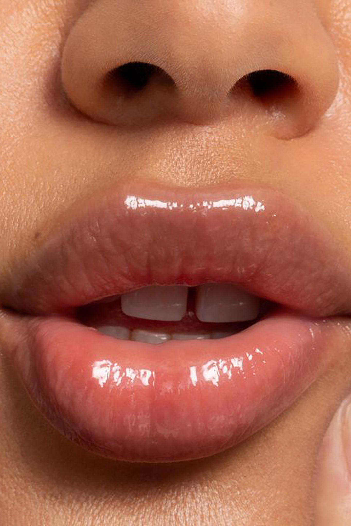 LIPID