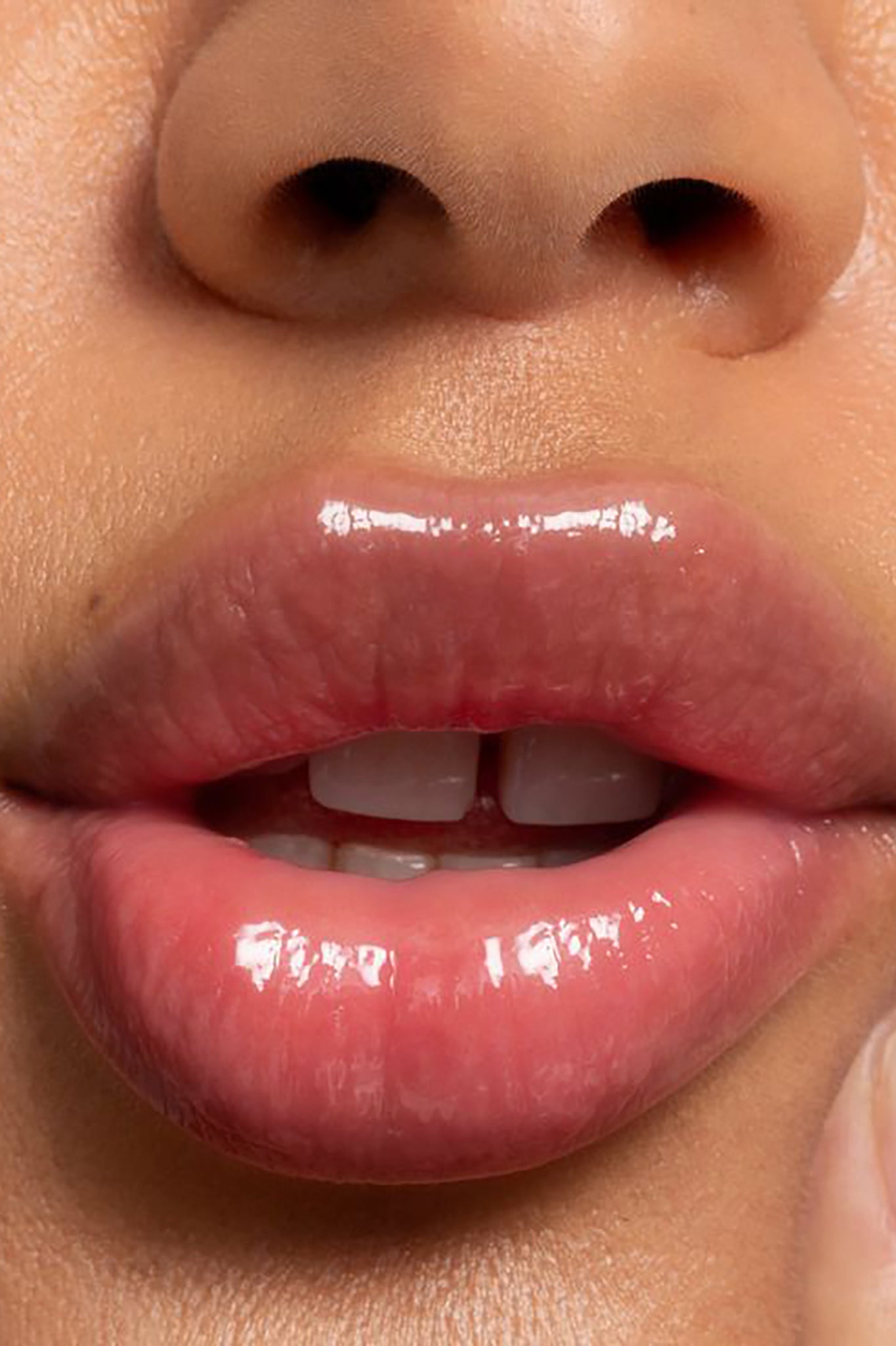 LIPID
