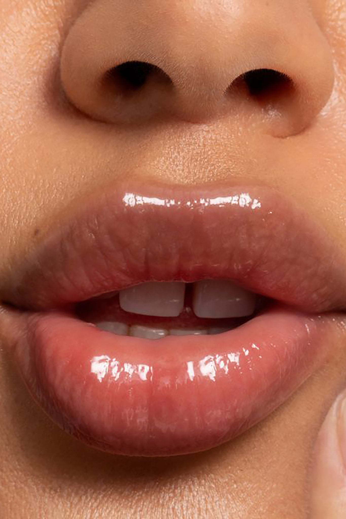 LIPID