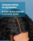 Ducray Anti-Dandruff Shampoo for Oily Scalp - Dermatologically Tested, 13.53 fl oz - view 7