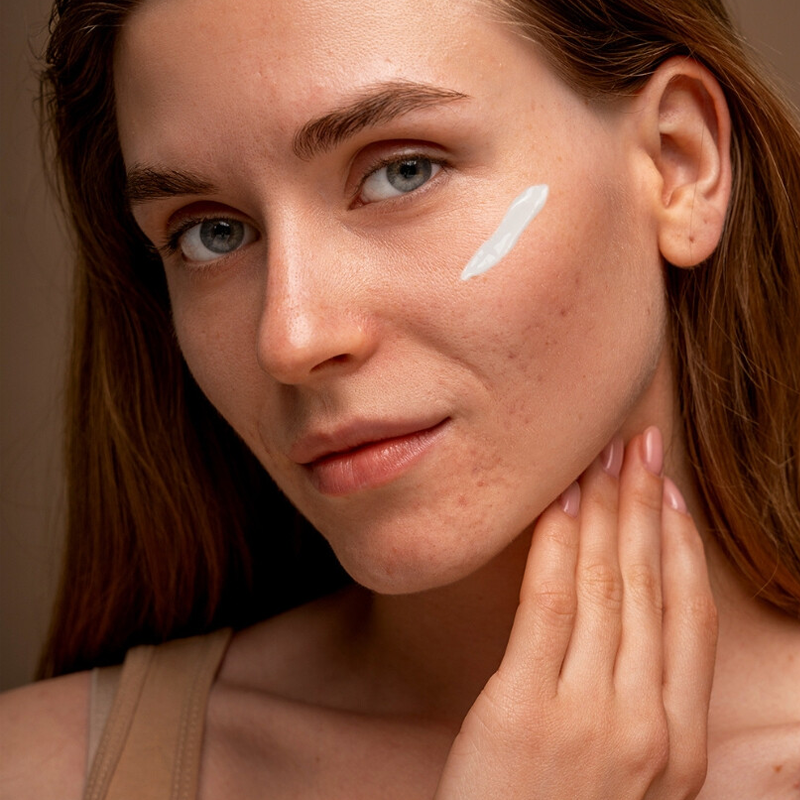 Minela Care SPF 50 Mineral Sunscreen for Uneven Skin 70g