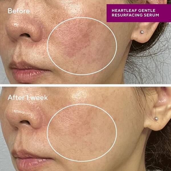 Murad Heartleaf Gentle Resurfacing Serum for Sensitive Skin 30ml