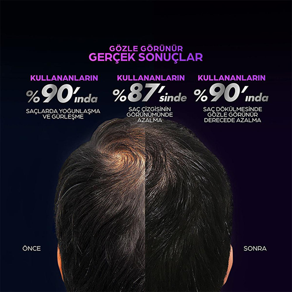 Clear Men Scalp Pro: Advanced Hair Growth Serum for Men - Clinically Proven Hair Loss Treatment - Strengthens & Thickens Hair for Increased Density Clear Men Hair Growth Serum: Thicken & Stop Hair Loss hair growth serum, hair loss treatment men, hair thinning serum, anti hair loss serum, men's hair growth products, hair density serum, scalp treatment for hair loss, Dynoxidil hair serum, hair strengthening serum, mens hair thickening products, hair growth, hair loss, thinning hair, scalp treatment, hair care
