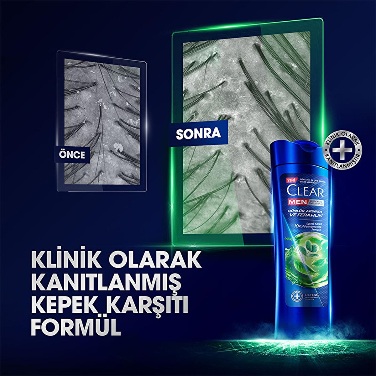 Clear Men: Advanced Anti-Dandruff Shampoo for Men - Cedarwood Eucalyptus - Itchy &amp; Oily Scalp Relief - 48H Freshness Clear Men Anti-Dandruff Shampoo - Itchy Scalp Relief anti-dandruff shampoo for men, clear men shampoo, shampoo for itchy scalp, shampoo for oily scalp, cedarwood eucalyptus shampoo, men&#39;s daily cleansing shampoo, kepeğe karşı etkili şampuan, shampoo with taurine and vitamin B3, anti-dandruff shampoo, dry scalp shampoo men, anti dandruff shampoo, itchy scalp shampoo, oily scalp shampoo, cedarw