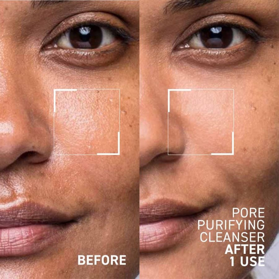 125ml - Deep Clean for Pores