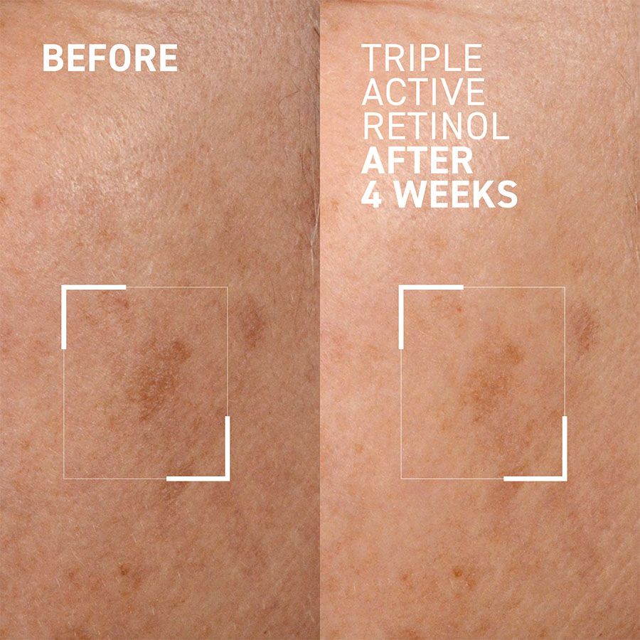 Dr. Brandt Triple Active Retinol Anti-Wrinkle Treatment 30g