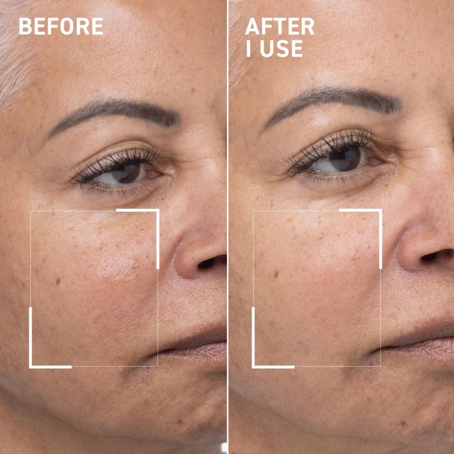 Dr. Brandt Oxygen Facial Mask Revitalizing Skin Treatment 50ml