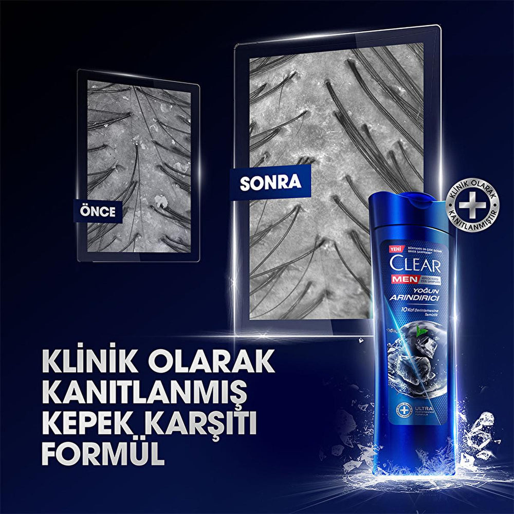 Clear Men: Intense Clean Anti-Dandruff Charcoal Shampoo - Deeply Cleanses Oily, Itchy Scalp & Controls Dandruff for Men - 11.83 fl oz Clear Men Charcoal Shampoo: Anti-Dandruff, Deep Cleanse anti-dandruff shampoo, men's shampoo, charcoal shampoo, deep cleansing shampoo, shampoo for oily scalp, shampoo for itchy scalp, kepek şampuanı, men's anti dandruff shampoo, purifying shampoo, oil control shampoo, shampoo, men's hair care, dandruff treatment, itchy scalp relief, oily scalp solution, charcoal, taurine, am